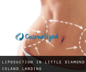 Liposuction in Little Diamond Island Landing
