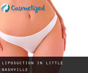 Liposuction in Little Nashville