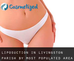 Liposuction in Livingston Parish by most populated area - page 1