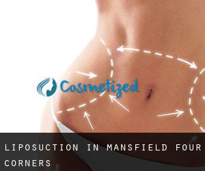 Liposuction in Mansfield Four Corners