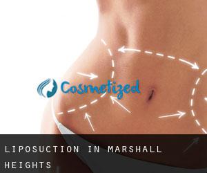 Liposuction in Marshall Heights