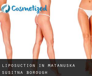 Liposuction in Matanuska-Susitna Borough
