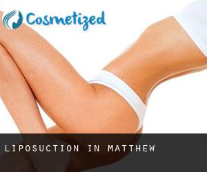 Liposuction in Matthew