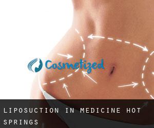 Liposuction in Medicine Hot Springs
