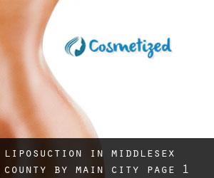 Liposuction in Middlesex County by main city - page 1