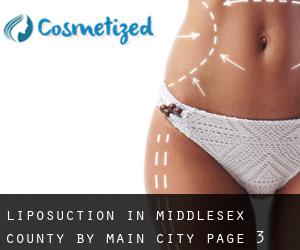 Liposuction in Middlesex County by main city - page 3