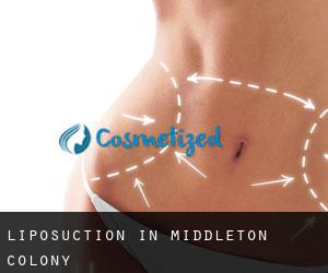 Liposuction in Middleton Colony