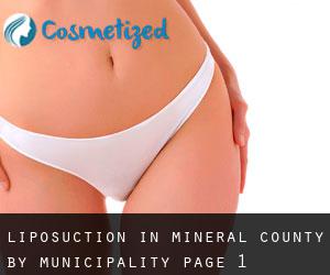 Liposuction in Mineral County by municipality - page 1