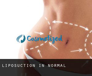 Liposuction in Normal