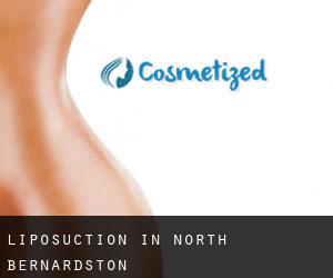 Liposuction in North Bernardston