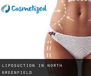 Liposuction in North Greenfield