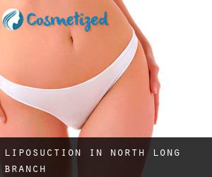 Liposuction in North Long Branch