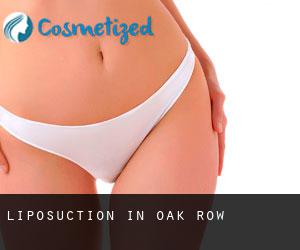 Liposuction in Oak Row