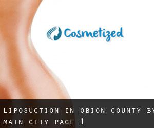 Liposuction in Obion County by main city - page 1