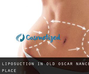 Liposuction in Old Oscar Nance Place