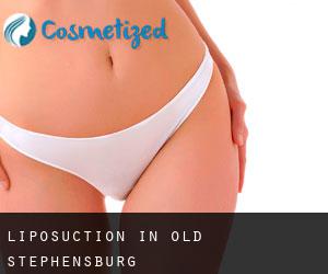 Liposuction in Old Stephensburg