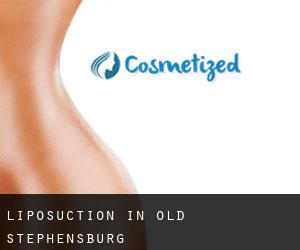 Liposuction in Old Stephensburg