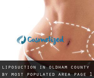 Liposuction in Oldham County by most populated area - page 1