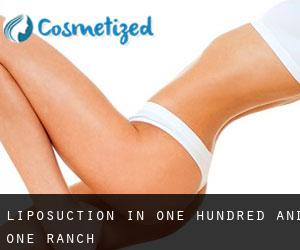 Liposuction in One Hundred and One Ranch