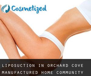 Liposuction in Orchard Cove Manufactured Home Community