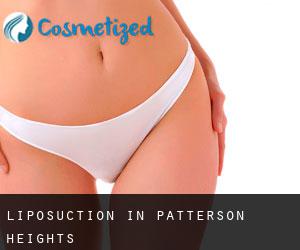 Liposuction in Patterson Heights
