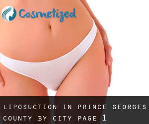 Liposuction in Prince Georges County by city - page 1