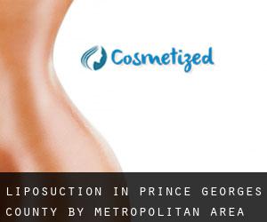 Liposuction in Prince Georges County by metropolitan area - page 2