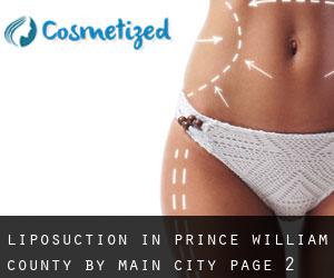 Liposuction in Prince William County by main city - page 2