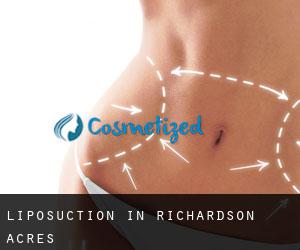 Liposuction in Richardson Acres