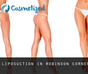 Liposuction in Robinson Corner