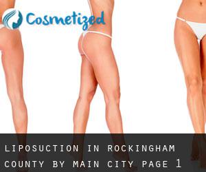 Liposuction in Rockingham County by main city - page 1