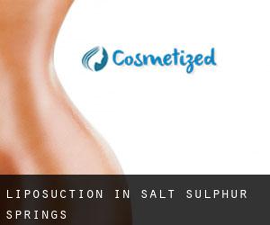 Liposuction in Salt Sulphur Springs