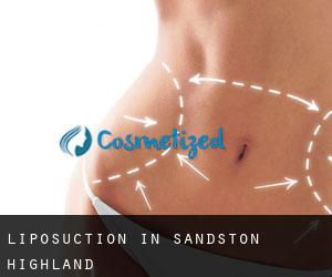 Liposuction in Sandston Highland