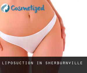 Liposuction in Sherburnville