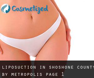 Liposuction in Shoshone County by metropolis - page 1