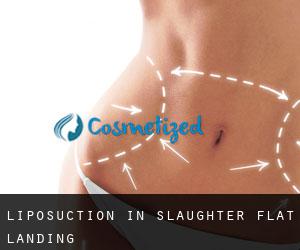 Liposuction in Slaughter Flat Landing