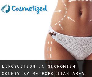Liposuction in Snohomish County by metropolitan area - page 1
