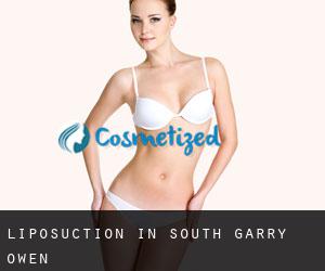 Liposuction in South Garry Owen