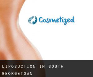 Liposuction in South Georgetown