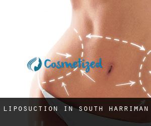 Liposuction in South Harriman