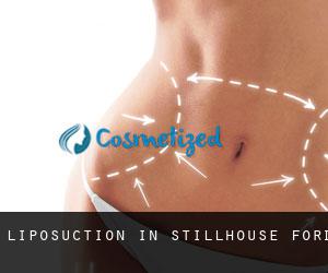 Liposuction in Stillhouse Ford