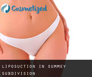 Liposuction in Summey Subdivision