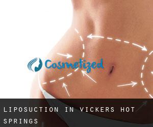 Liposuction in Vickers Hot Springs