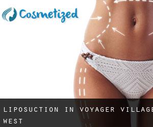 Liposuction in Voyager Village West