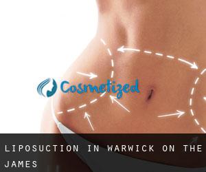 Liposuction in Warwick on the James
