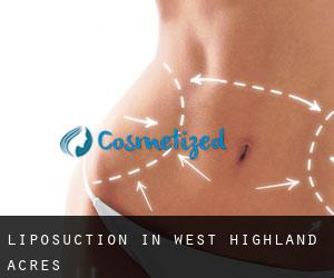 Liposuction in West Highland Acres