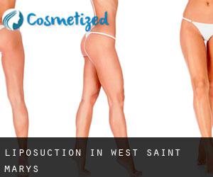Liposuction in West Saint Marys