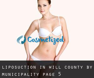 Liposuction in Will County by municipality - page 5