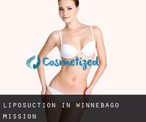 Liposuction in Winnebago Mission