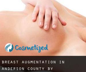 Breast Augmentation in Anderson County by metropolitan area - page 1